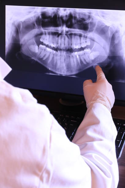 Best Emergency Tooth Extraction  in Shell Ridge, CA