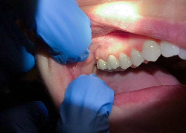 Best Walk-In Dentist Near Me  in Shell Ridge, CA