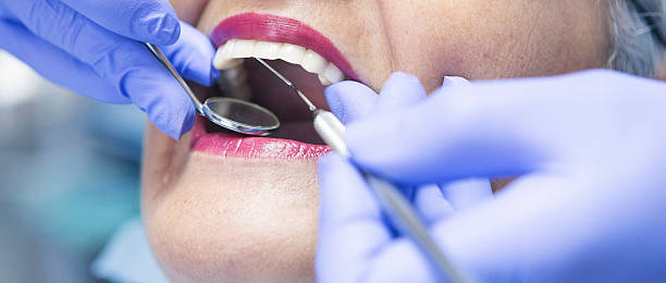 Best Cracked Tooth Emergency Dentist  in Shell Ridge, CA